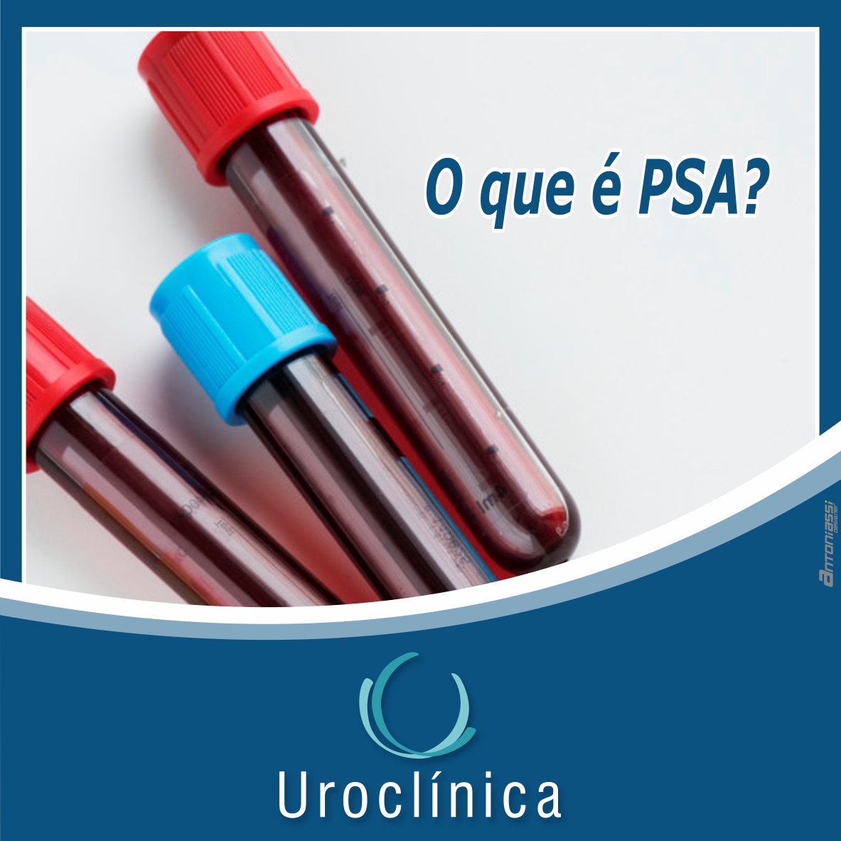 O que é o PSA (Antígeno