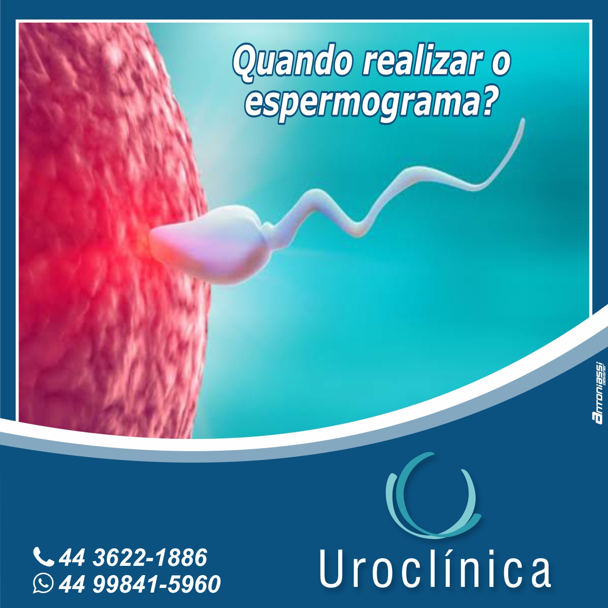Como interpretar o espermograma? | Uroclinica Umuarama